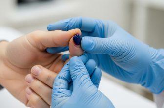 Ngón tay bị tụ máu dưới móng và hình ảnh thăm khám y tế.