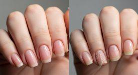 Móng tay chắc khỏe và móng tay yếu dễ gãy để minh họa sự khác biệt và mục tiêu phục hồi.