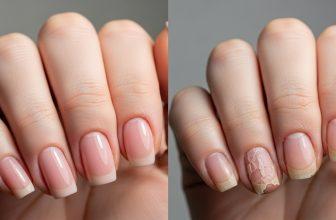 Móng tay chắc khỏe và móng tay yếu dễ gãy để minh họa sự khác biệt và mục tiêu phục hồi.