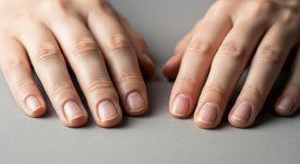 Móng tay bị sọc dọc và móng tay khỏe mạnh