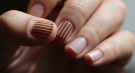 Hình ảnh cận cảnh móng tay người với vệt sọc nâu dọc, gợi lên sự lo lắng về sức khỏe.