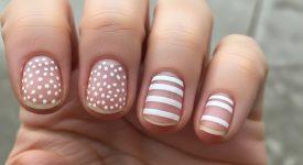 So sánh các dạng vệt trắng trên móng tay: đốm nhỏ và vệt sọc ngang