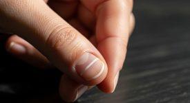 Bàn tay với móng có vệt trắng ngang, biểu thị sự lo lắng về sức khỏe móng.