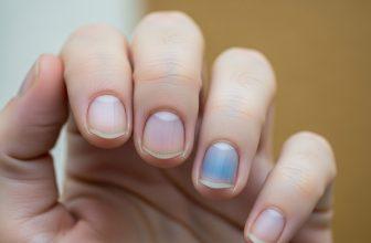 Móng tay màu tím nhạt là dấu hiệu của tình trạng thiếu oxy trong máu.