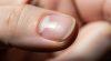 Hình ảnh cận cảnh móng tay khỏe mạnh, cho thấy tốc độ mọc móng tay trung bình.