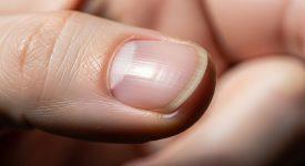 Hình ảnh cận cảnh móng tay khỏe mạnh, cho thấy tốc độ mọc móng tay trung bình.