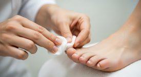 Quy trình vệ sinh và băng bó móng chân bị bật tại nhà