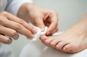 Quy trình vệ sinh và băng bó móng chân bị bật tại nhà