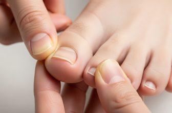 Người tự kiểm tra gốc móng chân tại nhà, tập trung vào vùng gốc móng.