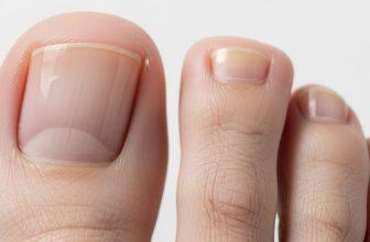 Móng chân khỏe mạnh và móng chân mọc chậm hoặc có dấu hiệu bất thường.